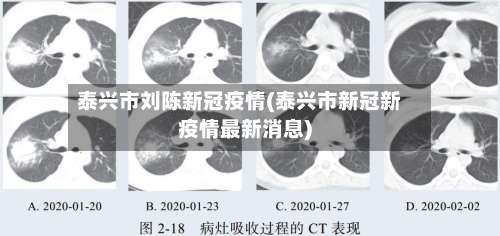 泰兴市刘陈新冠疫情(泰兴市新冠新疫情最新消息)-第2张图片